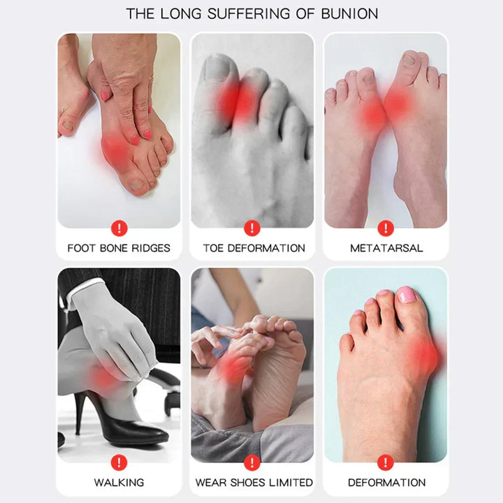 1+1 GRATIS | Hallux Valgus™ | Twoje wygodne rozwiązanie na stopy bez bólu!
