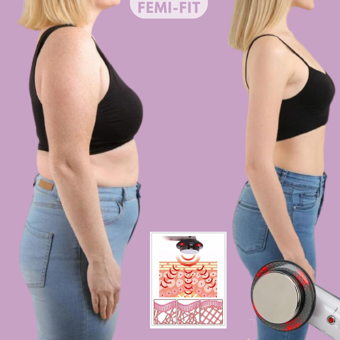 Usuwanie tłuszczu i cellulitu 3-w-1 – SlimShape