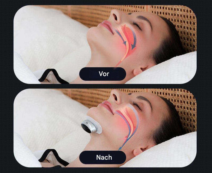 Urządzenie na bezdech senny - AirEase